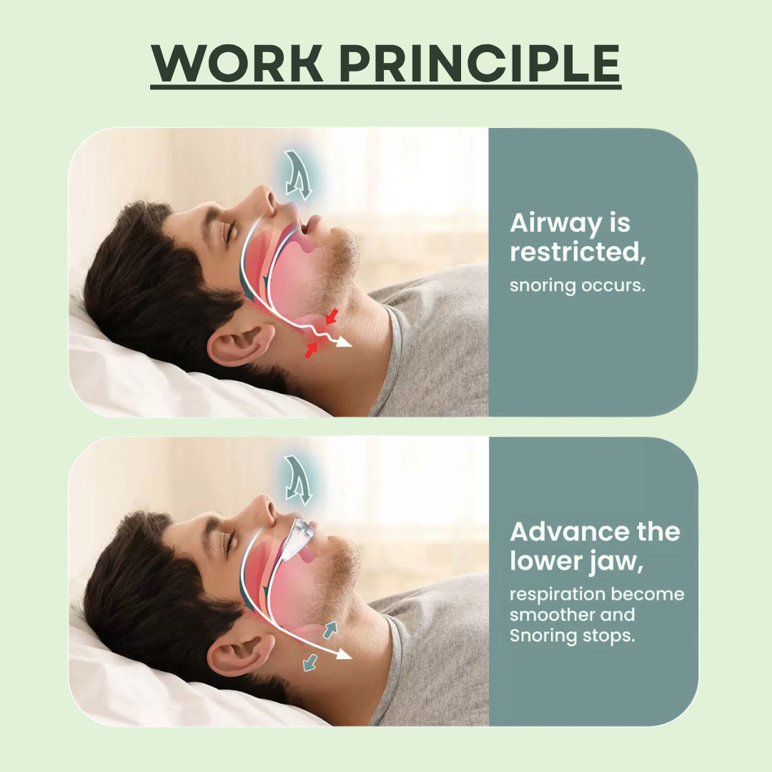 The Silent Anti-Snoring Mouthpiece